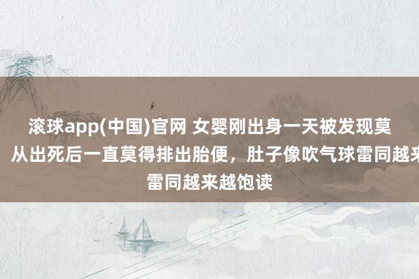 滚球app(中国)官网 女婴刚出身一天被发现莫得肛门，从出死后一直莫得排出胎便，肚子像吹气球雷同越来越饱读
